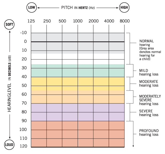 Audiology Hearing Test Chart
