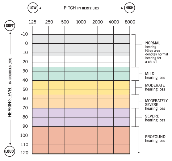 Hearing Test - Pure-tone audiometry on Android