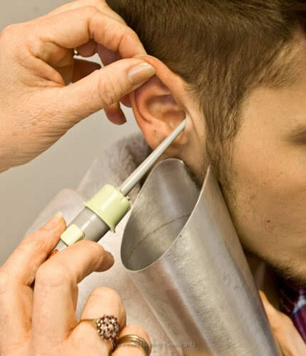 remove ear wax professionally